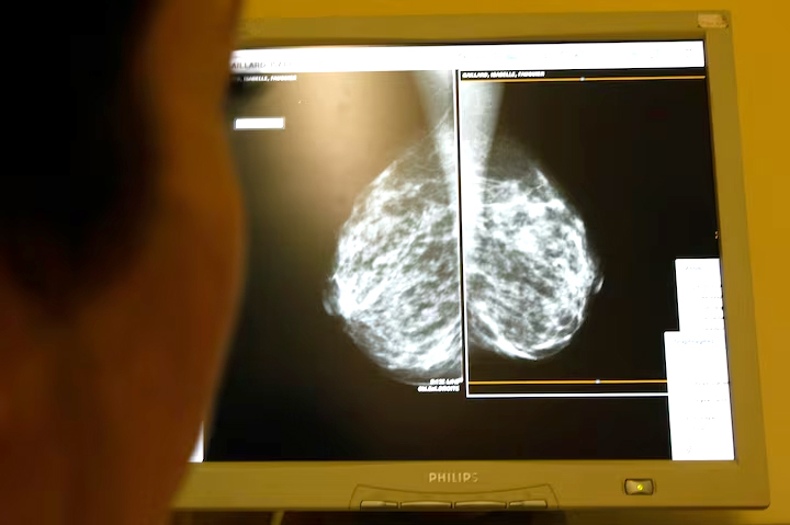 image Cyprus-led team makes breast, ovarian cancer breakthrough